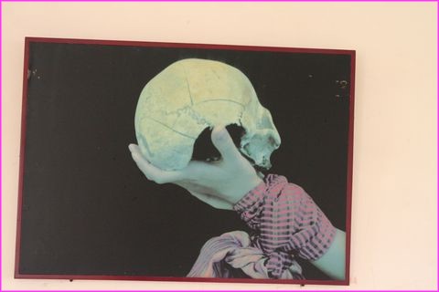 Une des victimes des Kmers Rouges, avec trace des f�lures suite aux coups.